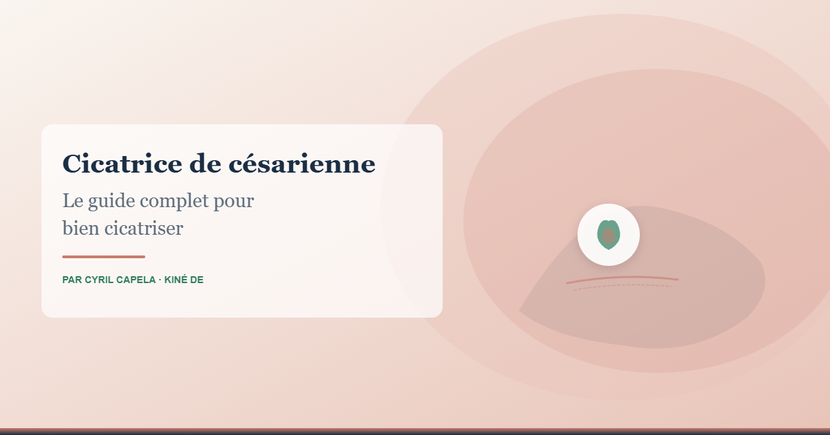 Cicatrice de césarienne - guide complet