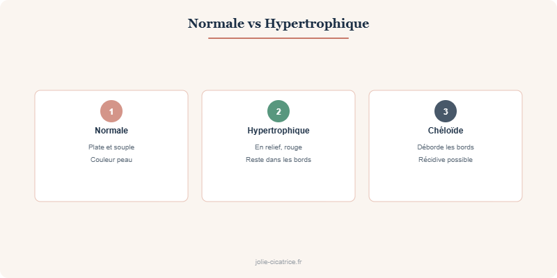 Normale vs Hypertrophique